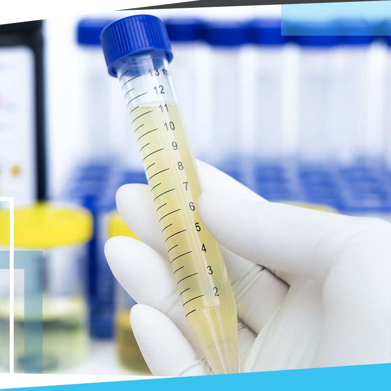 Bendras šlapimo tyrimas – Sporto Klinika